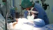 Inovasi Operasi Bypass Jantung dengan Metode MICS