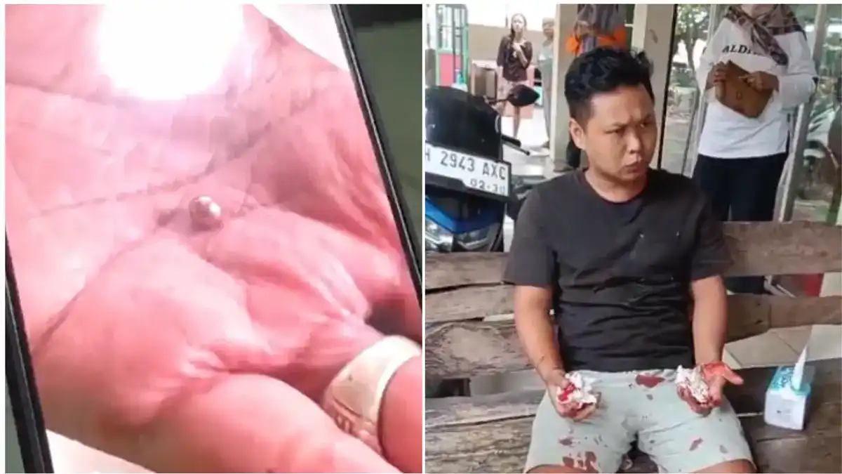 Tukang Tambal Ban di Boyolali Jalani Operasi Setelah Ditembak Gotri